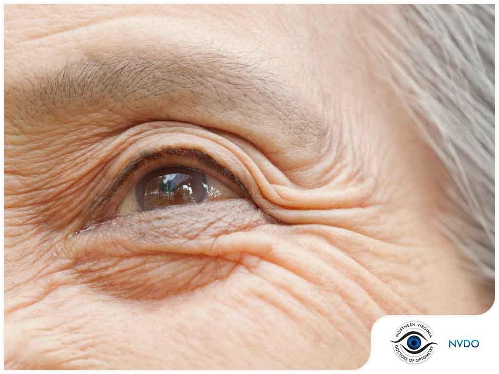 Golden Eyes Optometry